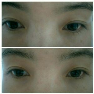 本人自用眼膜效果,眼部细纹没有了,黑眼圈淡了很多 本人自用眼膜效果,眼部细纹没有了,黑眼圈淡了很多