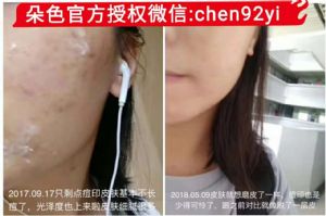 �����Ч����ô�������ϵĲ�����ȫ��