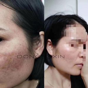 ����Ч���õĻ���Ʒ�����������׺��и��������Ч������