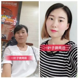 一叶子面膜怎么加入,微商怎么代理? 一叶子面膜怎么加入,微商怎么代理?