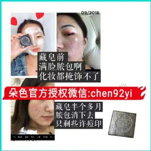 ��������Ǯ�����Ч������