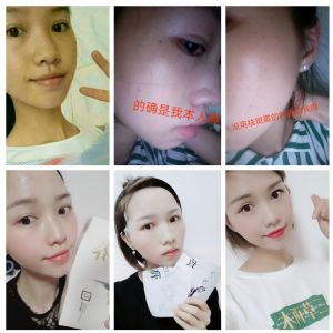 三草两木护肤品效果真的好吗?安全吗?廖婷婷受益者她告诉 三草两木护肤品效果真的好吗?安全吗?廖婷婷受益者她告诉