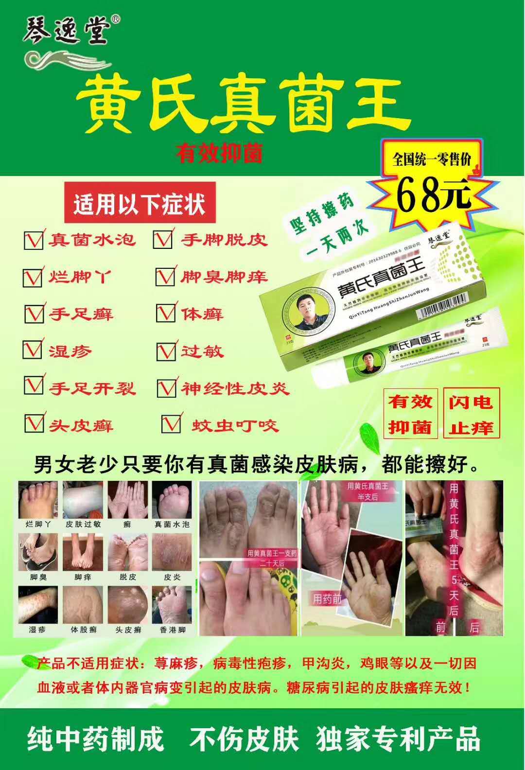 黄氏真菌王针对哪些管用?有jiahuo吗?代理找谁? 黄氏真菌王针对哪些管用?有jiahuo吗?代理找谁?